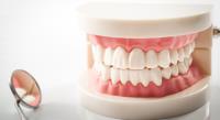 Bardgett Denture & Implant Solutions image 2